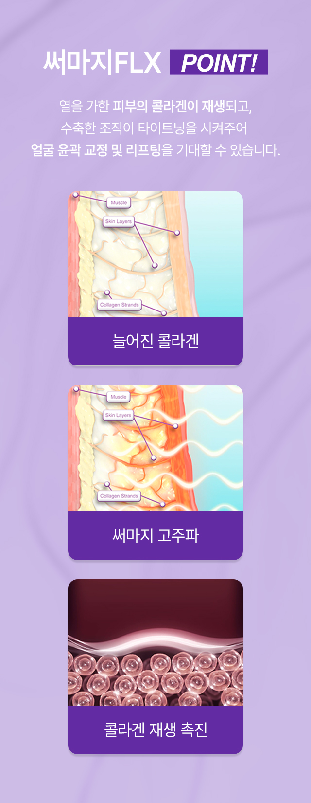 써마지FLX