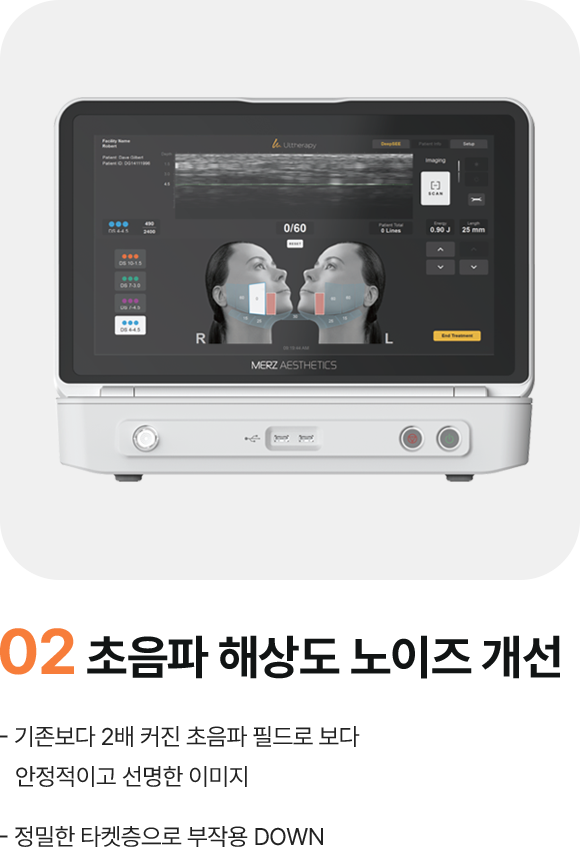 02 초음파 해상도 노이즈 개선