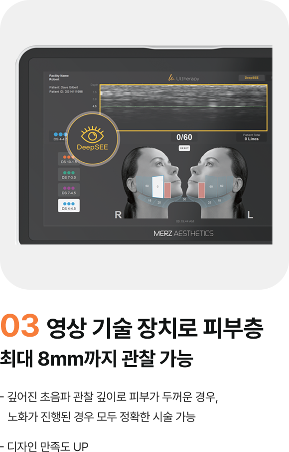 03 영상 기술 장치로 피부층 최대 8mm까지 관찰 가능