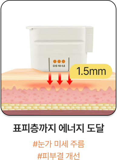 표피층까지 에너지 도달,표진피층까지 에너지 전달,근막층까지 에너지 전달