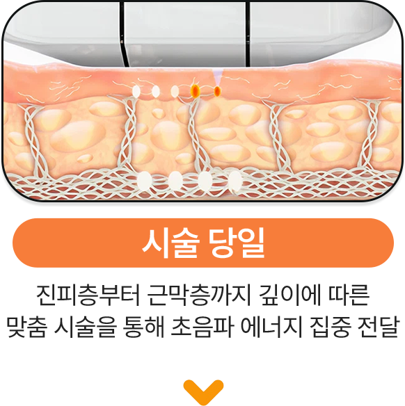 시술당일