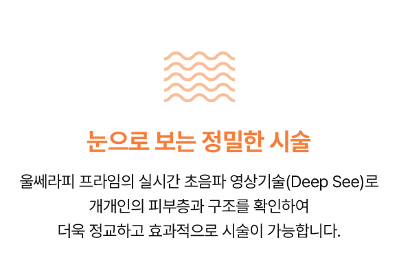 울쎄라피 프라임 정품팁 사용,최적화된 콜라겐 생성 온도,최적화된 콜라겐 생성 온도,눈으로 보는 정밀한 시술