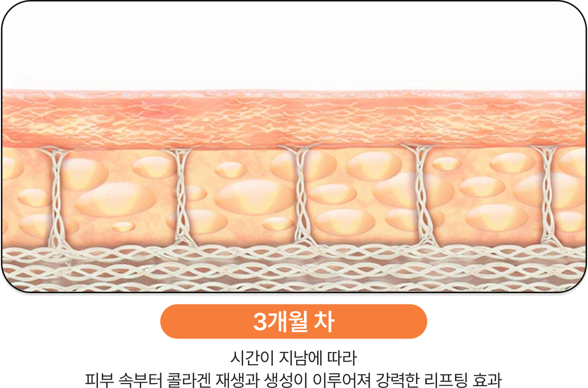 3개월차